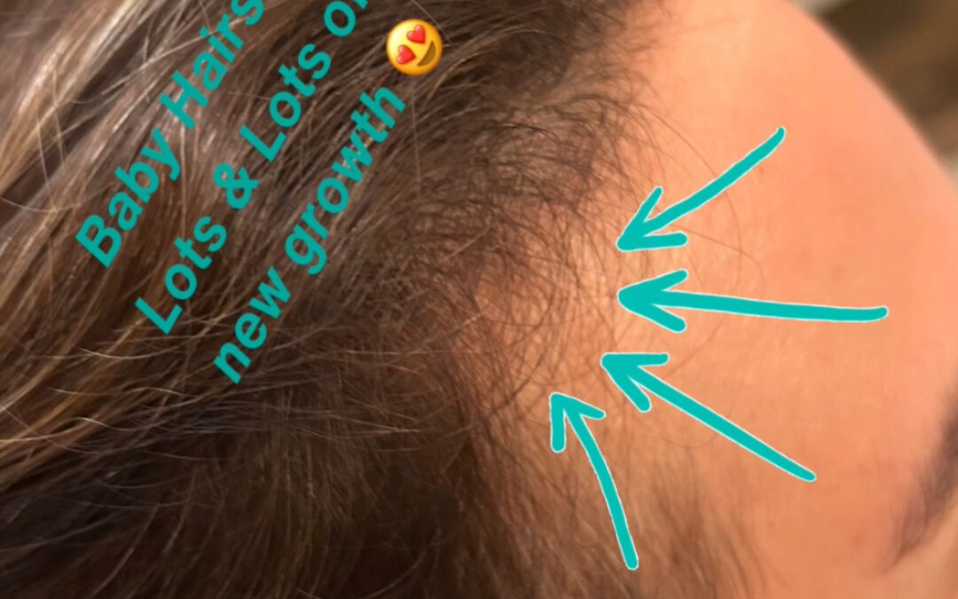 Excessive Hair Shedding: What It Means and How to Address It from the Inside Out