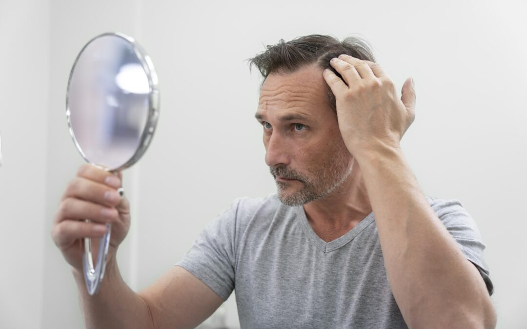 Finasteride and Hair Loss: What You Should Know About Mental Health Risks
